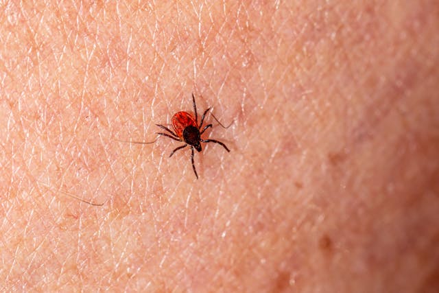 Justin Timberlake e la malattia di Lyme: cos'è e come si cura