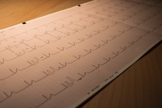 I farmaci beta-bloccanti sono realmente utili per i pazienti che hanno subito un infarto?
