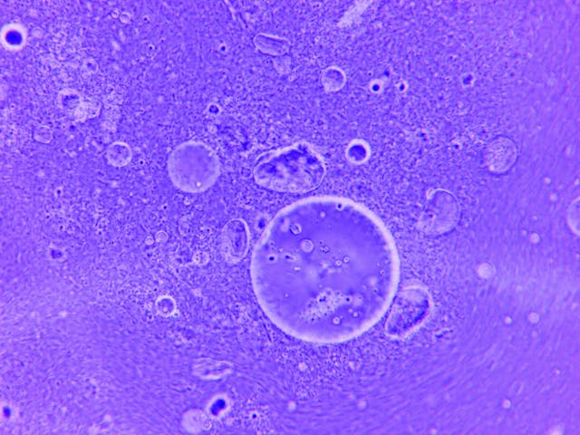 Malattie rare: nuova analisi 3D dei lisosomi