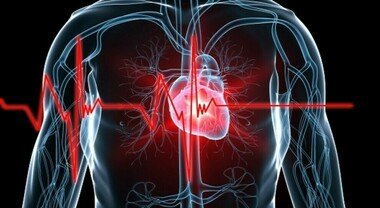 MALATTIE CARDIACHE